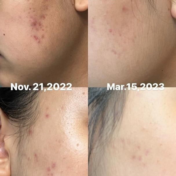 سرم روشنکننده و ضد لک برند اکسیس وای