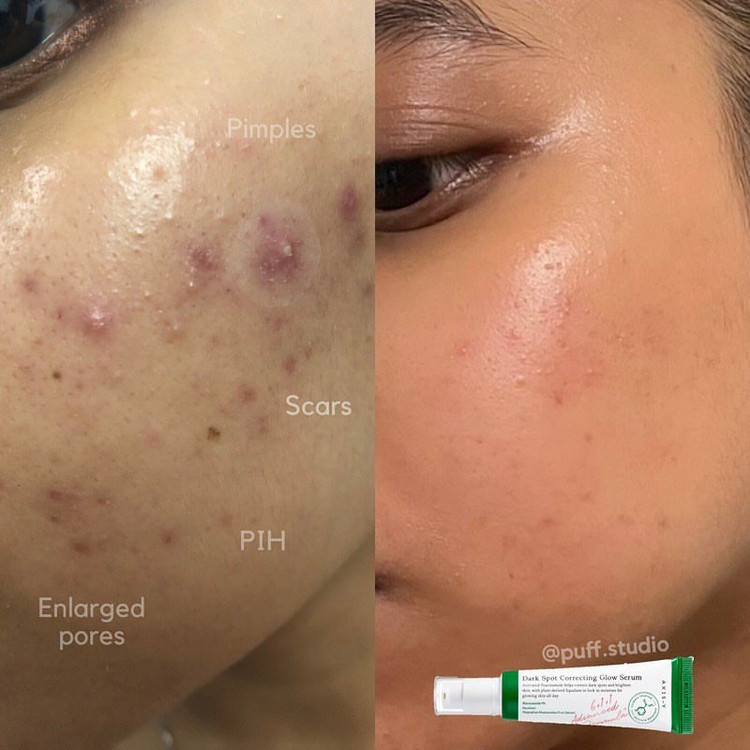 بستهبندی سرم ضد لک AXIS-Y حجم 50ml