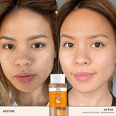 تونر REN روشنکننده و لایهبردار AHA