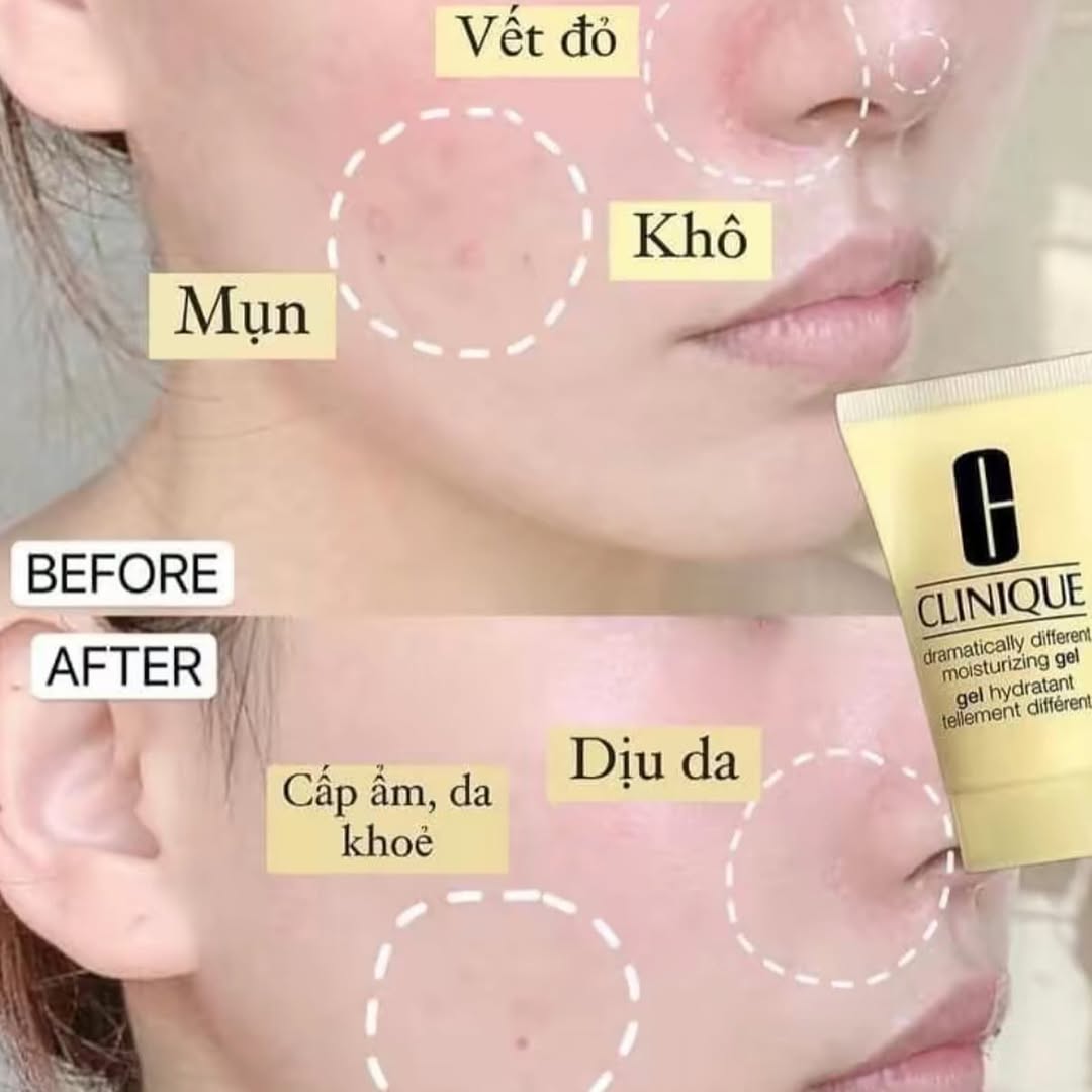 ژل آبرسان کلینیک مدل Dramatically Different Moisturizing Gel – ۳۰ میلی‌لیتر